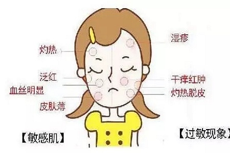 皮膚變成敏感肌怎么辦？如何修復(fù)敏感??？