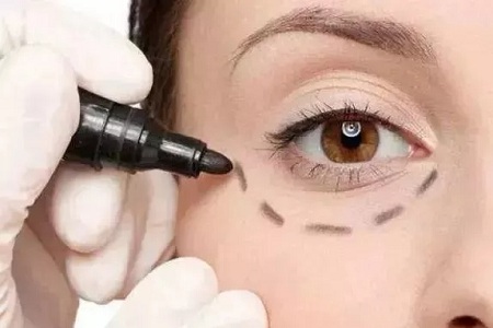 每到放假，做這個項目的人就會增多！--眼袋