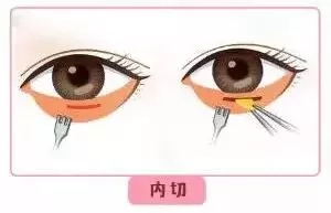 每到放假，做這個項目的人就會增多！--眼袋