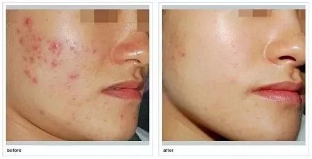 如何在炎熱的夏天，做清爽白凈的小姐姐？