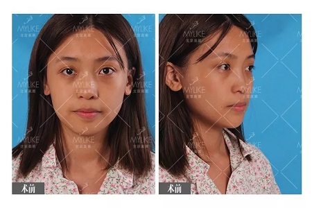 顏值：鼻子一小步，顏值一大步~