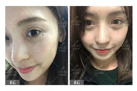 顏值：鼻子一小步，顏值一大步~