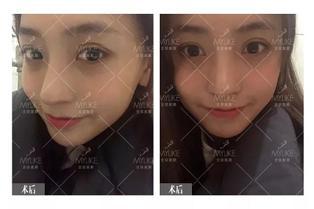 顏值：鼻子一小步，顏值一大步~