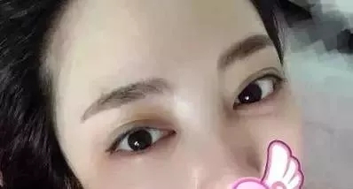 水光，打1次和4次究竟有多大區(qū)別？