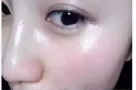 水光，打1次和4次究竟有多大區(qū)別？