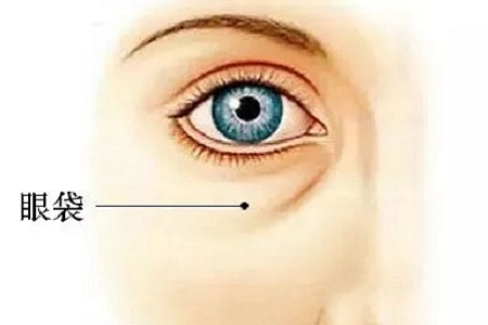 還把眼袋當臥蠶？那就別怪小弟弟喊你阿姨了