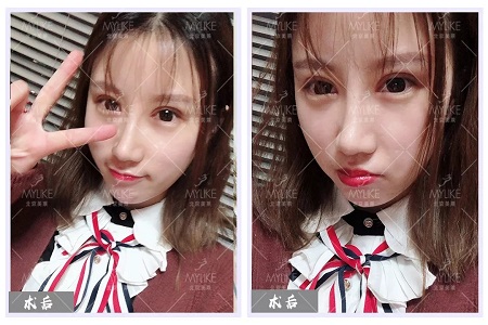 顏值：修復(fù)后的雙眼，美瞎一路