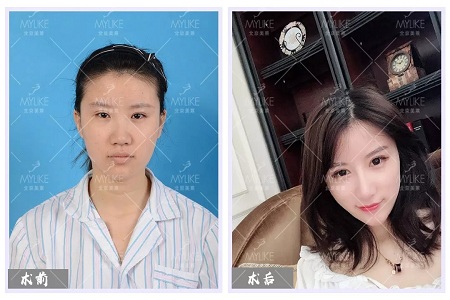 顏值：修復(fù)后的雙眼，美瞎一路