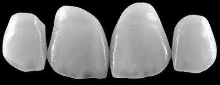 牙齒也能敷“面膜”？這款明星美牙秘籍了解下