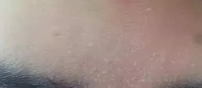 粗糙、毛孔粗大、起皮......換季肌膚問題如何解決？