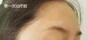 粗糙、毛孔粗大、起皮......換季肌膚問題如何解決？