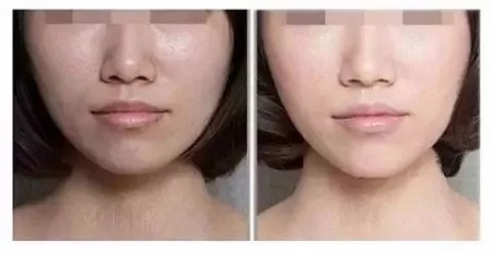 粗糙、毛孔粗大、起皮......換季肌膚問題如何解決？