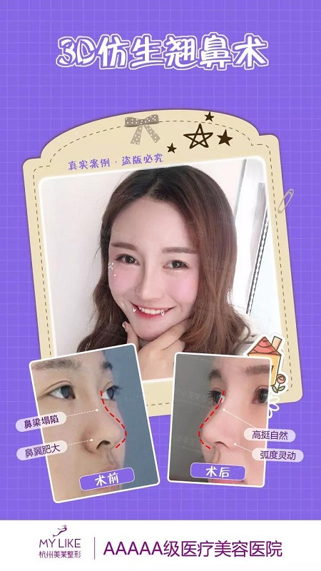 CURE全度美眸，仿生3D翹鼻，想美哪里你來定