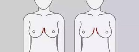 一味追求大胸的她們，卻忽略了這個問題...