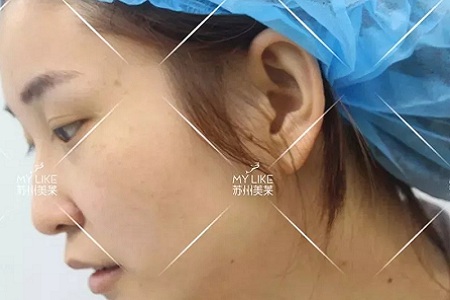 鼻子不是越高越好看！