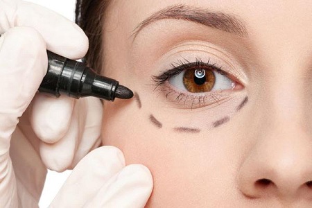 眼袋也分很多類型，看看你屬于哪一型？