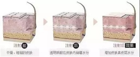 水光迎夏，“針”美麗