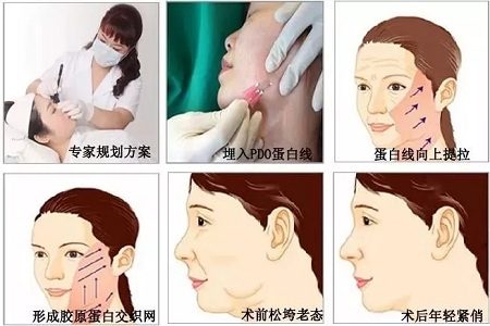 關于*雕，你想了解的都在這里！