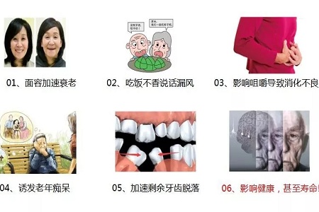 牙齒缺失時，選烤瓷牙還是那種？