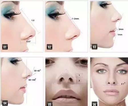 假體隆鼻的“高度”主要決定于哪些因素？