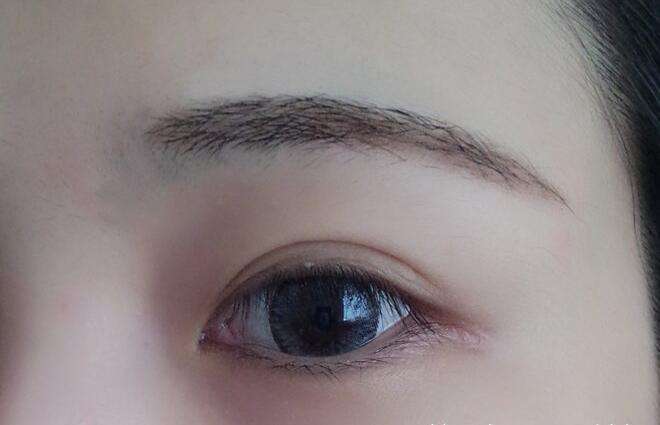 去眼袋一般多少錢(qián)