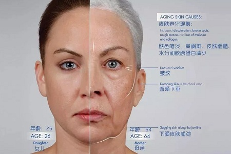 皺紋、松垂、凹陷，三大衰老癥狀，怎么解決？