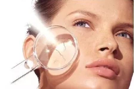 夏天那么曬，這個(gè)時(shí)候做祛斑真的靠譜嗎？