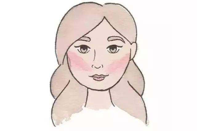 玻尿酸去法令紋