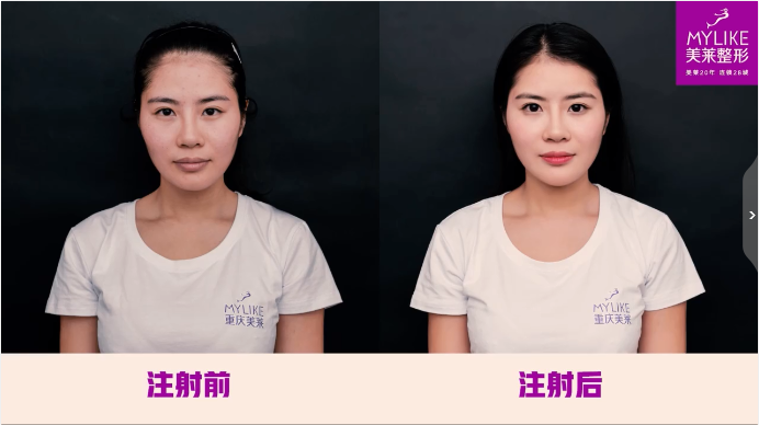 重慶美萊醫(yī)美秘籍美萊光影藝術面雕