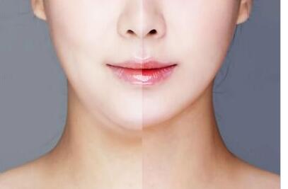 杭州面部吸脂價(jià)位多少錢(qián)