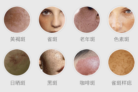 鄭州美萊整形祛斑怎么樣？