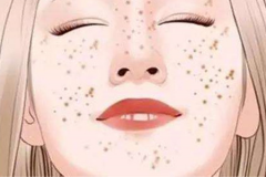 鄭州美萊祛雀斑效果怎么樣？