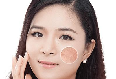 成都美萊光子嫩膚多少錢(qián)