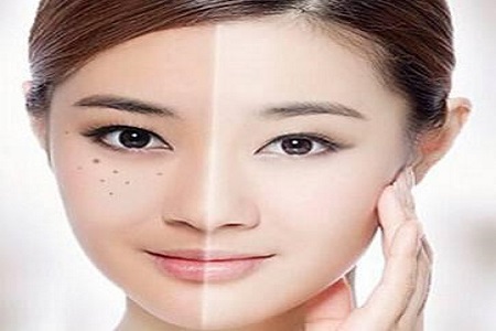 彩光嫩膚美白多少錢