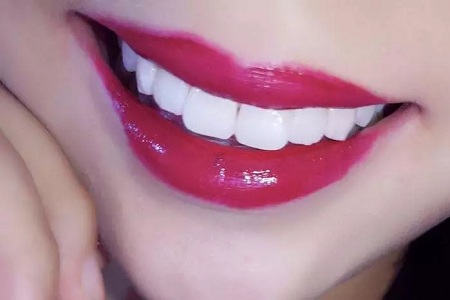 <a href='/wzhm/' target='_blank'><u>萬州華美</u></a>冷光美白牙齒多少錢