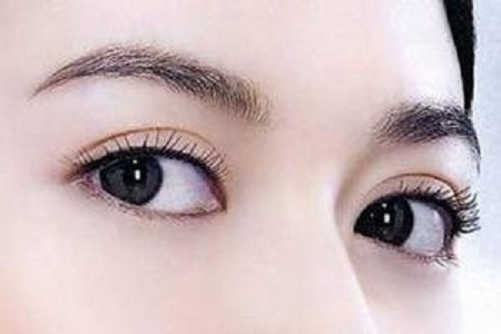 開眼角手術(shù)費用多少 媚眼勾魂！