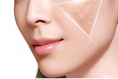 佛山祛斑效果好嗎？注意這幾點就好了