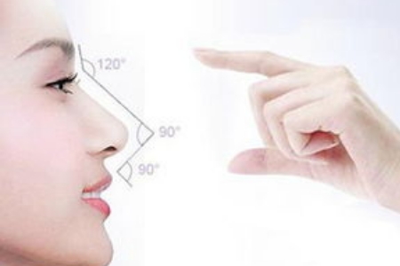 昆明自體組織隆鼻維持多久，效果好嗎？