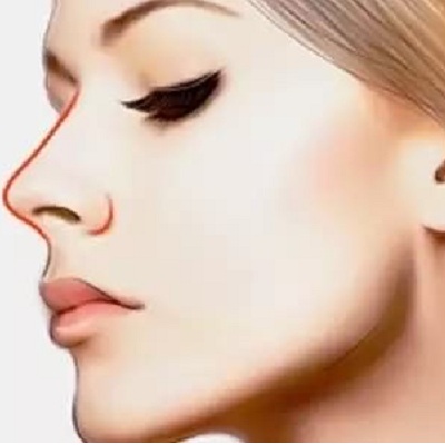 鼻部修復(fù)價(jià)錢