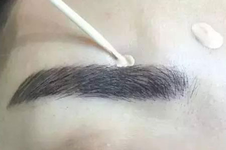 眉毛種植手術過程是怎樣的，多久能看到效果