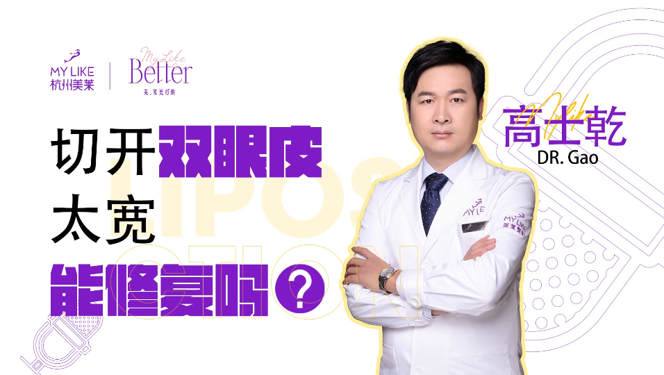 杭州美萊：切開雙眼皮太寬能修復嗎？
