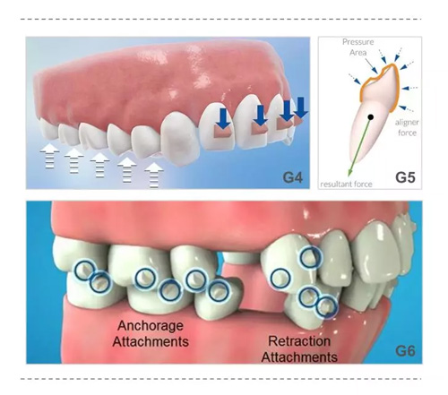 美萊隆重推出雙旦福利，報(bào)名體驗(yàn)牙齒矯正黑科技iTero 口掃