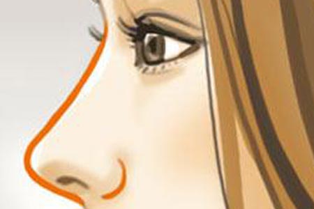 隆鼻術(shù)后注意什么