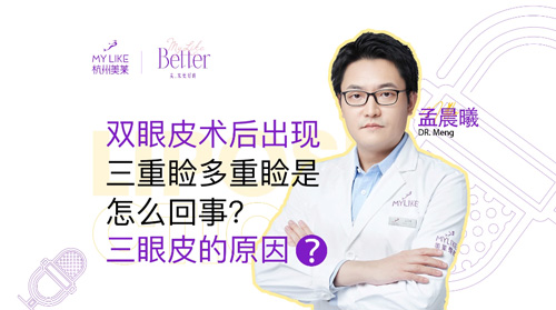 杭州美萊：雙眼皮術后出現(xiàn)三重瞼多重瞼是怎么回事？