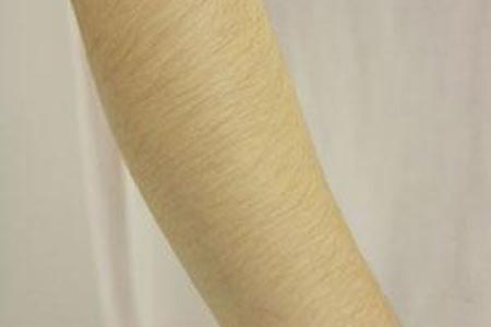 冰點(diǎn)手臂脫毛效果好不好